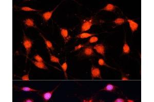 Immunofluorescence analysis of C6 cells using METTL3 Polyclonal Antibody at dilution of 1:100 (40x lens). (METTL3 antibody)