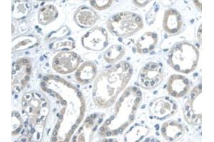 Detection of GAL2 in Human Kidney Tissue using Monoclonal Antibody to Galectin 2 (GAL2) (Gallinacin-2 (GAL2) (AA 1-132) antibody)