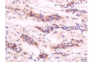 Formalin-fixed and paraffin embedded human kidney labeled with Anti-GM2A Polyclonal Antibody, Unconjugated  at 1:200 followed by conjugation to the secondary antibody and DAB staining (GM2A antibody  (AA 131-193))