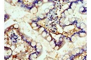 Immunohistochemistry of paraffin-embedded human small intestine tissue using ABIN7152503 at dilution of 1:100 (FBXW4 antibody  (AA 143-412))