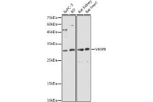 Western blot analysis of extracts of various cell lines, using VEGFB antibody (ABIN6128909, ABIN6150090, ABIN6150092 and ABIN6216417) at 1:1000 dilution. (VEGFB antibody  (AA 25-207))