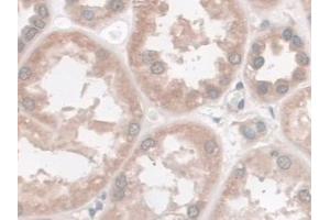 Immunohistochemistry (IHC) image for anti-Spectrin Repeat Containing, Nuclear Envelope 2 (SYNE2) (AA 6-296) antibody (ABIN7436189)
