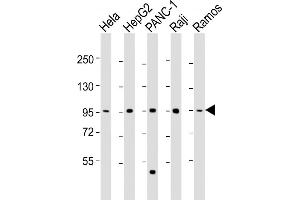 All lanes : Anti-NUGGC Antibody (Center) at 1:2000 dilution Lane 1: Hela whole cell lysate Lane 2: HepG2 whole cell lysate Lane 3: NC-1 whole cell lysate Lane 4: Raji whole cell lysate Lane 5: Ramos whole cell lysate Lysates/proteins at 20 μg per lane. (C8orf80 antibody  (AA 279-311))