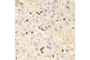 Immunohistochemistry of paraffin-embedded Human liver using LSP1 antibody at dilution of 1:100 (x400 lens).