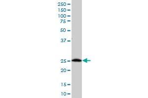 C21orf33 polyclonal antibody (A01), Lot # 060717JCS1 Western Blot analysis of C21orf33 expression in K-562 . (C21orf33 antibody  (AA 188-268))