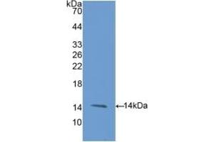 Detection of Recombinant ENG, Rat using Polyclonal Antibody to Endoglin (ENG) (Endoglin antibody  (AA 26-136))