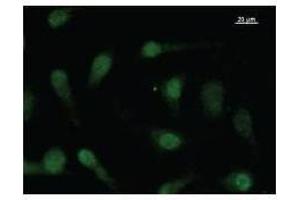 Immunostaining analysis in HeLa cells. (FBXO18 antibody)