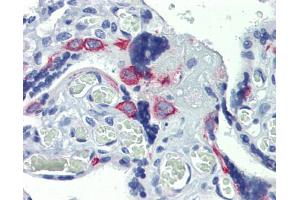 Human placenta; Anti-ZNF71 antibody IHC staining of human placenta.