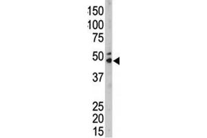 The SPHK1 antibody used in western blot to detect SPHK1 in mouse kidney tissue lysate (SPHK1 antibody  (AA 286-315))