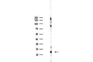 anti-Translocase of Outer Mitochondrial Membrane 22 Homolog (TOMM22) (pThr43) antibody