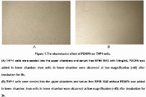 Image no. 3 for Platelet Derived Growth Factor A (PDGFA) (AA 94-194) (Active) protein (His tag) (ABIN6239819) (PDGFA Protein (AA 94-194) (His tag))