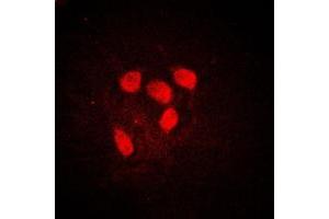 Immunofluorescent analysis of c-Myc (pS62) staining in HeLa cells. (c-MYC antibody  (N-Term, pSer62))