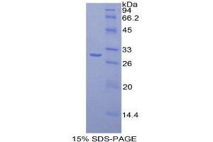 SDS-PAGE (SDS) image for Fatty Acid Synthase (FASN) (AA 2263-2512) protein (His tag) (ABIN1878276)