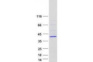 Validation with Western Blot (HYLS1 Protein (Transcript Variant 2) (Myc-DYKDDDDK Tag))