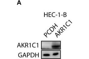 Western Blotting (WB) image for anti-Dihydrodiol Dehydrogenase (DDH) antibody (ABIN2856139)