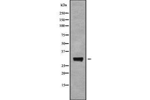 Western blot analysis of AQP6 using RAW264. (AQP6 antibody  (Internal Region))