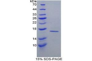 SDS-PAGE (SDS) image for Retinol Binding Protein 1, Cellular (RBP1) (AA 2-135) protein (His tag) (ABIN1980731) (RBP1 Protein (AA 2-135) (His tag))
