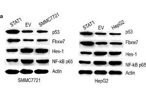 Effect of STAT1 on p53, Fbxw7, Hes-1 and NF-κB p65. (FBXW7 antibody  (AA 501-600))