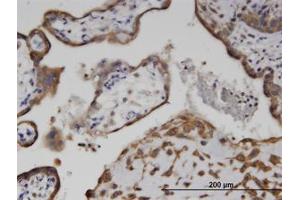 Image no. 1 for anti-Adenylate Kinase 9 (AK9) (AA 321-422) antibody (ABIN599621) (Adenylate Kinase 9 antibody  (AA 321-422))