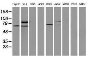 Image no. 2 for anti-SAM Domain and HD Domain 1 (SAMHD1) antibody (ABIN1500801) (SAMHD1 antibody)