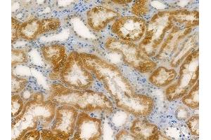 ABIN6259076 and ABIN6275942 at 1/100 staining human normal kidney tissue by IHC-P.