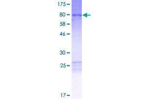 Image no. 1 for Ankyrin Repeat and Sterile alpha Motif Domain Containing 6 (ANKS6) (AA 1-471) protein (GST tag) (ABIN1345139) (ANKS6 Protein (AA 1-471) (GST tag))