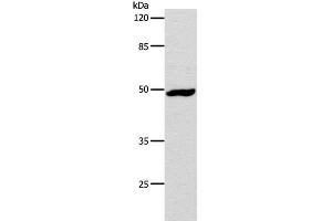 Western Blot analysis of Hela cell using DRD1 Polyclonal Antibody at dilution of 1:1000 (Dopamine Receptor d1 antibody)
