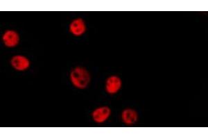 ABIN6274149 staining Hela by IF/ICC. (HMGN2 antibody  (Internal Region))