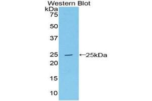 PSMB8 anticorps  (AA 75-261)