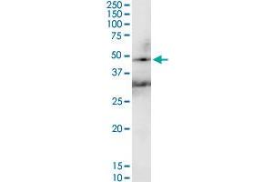 HAVCR1 MaxPab rabbit polyclonal antibody. (HAVCR1 antibody  (AA 1-364))