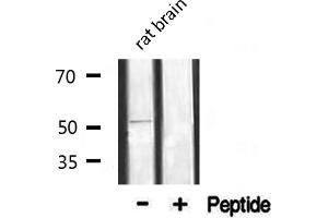 alpha 1 Adrenergic Receptor antibody  (Internal Region)