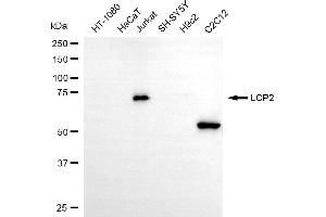 Western blotting analysis using LCP2 antibody (ABIN7799293).