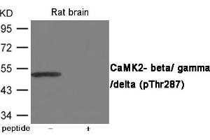 Western blot analysis of extracts from Rat brain using CaMK2- beta/ gamma/ delta (Phospho-Thr287) Antibody. (CAMK2D antibody  (pThr287))