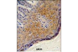 Formalin-fixed and paraffin-embedded human skin reacted with DERA Antibody (N-term), which was peroxidase-conjugated to the secondary antibody, followed by DAB staining. (DERA antibody  (N-Term))