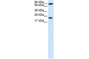 WB Suggested Anti-CBX5 Antibody Titration:  1. (CBX5 antibody  (Middle Region))