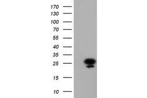 Western Blotting (WB) image for anti-Adenylate Kinase 3 (AK3) antibody (ABIN1496523) (Adenylate Kinase 3 antibody)