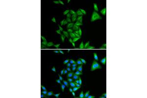Immunofluorescence (IF) image for anti-Phytanoyl-CoA 2-Hydroxylase (PHYH) antibody (ABIN1980320) (PHYH antibody)