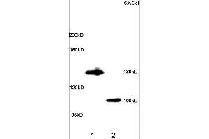 Lane 1: rat brain lysates Lane 2: rat lung lysates probed with Anti ADCY5 Polyclonal Antibody, unconjugated (ABIN751183) at 1:200 in 4 °C Followed by conjugation to secondary antibody (ABIN727474-HRP) at 1:3000 90min in 37 °C Predicted band 139kD. (ADCY5 antibody  (AA 857-909))