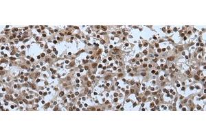 Immunohistochemistry of paraffin-embedded Human tonsil tissue using CELF5 Polyclonal Antibody at dilution of 1:65(x200)
