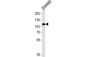 Western Blotting (WB) image for anti-Mitogen-Activated Protein Kinase Kinase Kinase 9 (MAP3K9) antibody (ABIN3003606) (MAP3K9 antibody)