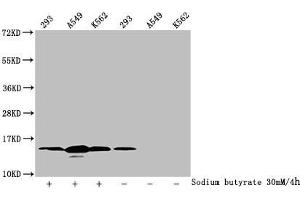 Western Blot Detected samples: 293 whole cell lysate, A549 whole cell lysate, K562 whole cell lysate, Untreated (-) or treated (+) with 30 mM sodium butyrate for 4h All lanes: HIST1H2BC antibody at 1:100 Secondary Goat polyclonal to rabbit IgG at 1/50000 dilution Predicted band size: 14 kDa Observed band size: 14 kDa (Histone H2B antibody  (acLys12))