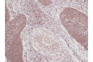 Image no. 1 for anti-Colony Stimulating Factor 2 (Granulocyte-Macrophage) (CSF2) antibody (ABIN465581) (GM-CSF antibody)
