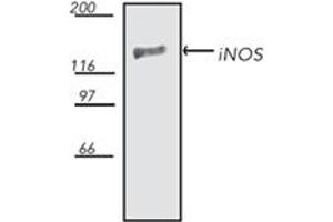 Western blot analysis: rat brain extract, probed with iNOS, pAb. (NOS2 antibody  (AA 1131-1144))