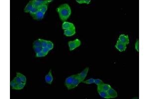 Immunofluorescence staining of PC-3 cells with ABIN7151823 at 1:50, counter-stained with DAPI. (NGEF antibody  (AA 495-710))