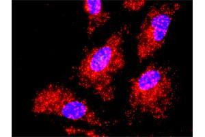Proximity Ligation Analysis of protein-protein interactions between IKBKB and TRAF2. (TRAF2 antibody  (AA 1-501))