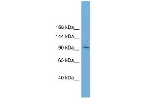 WB Suggested Anti-STK31 Antibody Titration:  0. (STK31 antibody  (N-Term))