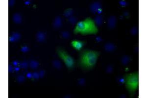 Image no. 2 for anti-Aldehyde Dehydrogenase 3 Family, Member A1 (ALDH3A1) antibody (ABIN1496591) (ALDH3A1 antibody)