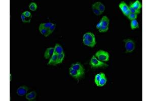 Immunofluorescent analysis of MCF-7 cells using ABIN7170239 at dilution of 1:100 and Alexa Fluor 488-congugated AffiniPure Goat Anti-Rabbit IgG(H+L) (SLC35F6 antibody  (AA 337-371))