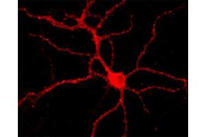 Immunofluorescence labeling of a hippocampus neuron (dilution 1 : 1000). (Dynamin 3 antibody  (AA 773-794))