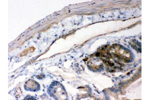 Immunohistochemistry (IHC) image for anti-Nuclear Factor of kappa Light Polypeptide Gene Enhancer in B-Cells Inhibitor, alpha (NFKBIA) (AA 3-112) antibody (ABIN3043889)